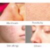 green-tea-cleansing-mask-stick-4034-04 Green Tea Cleansing Mask Stick – 2-Bottle Pack
