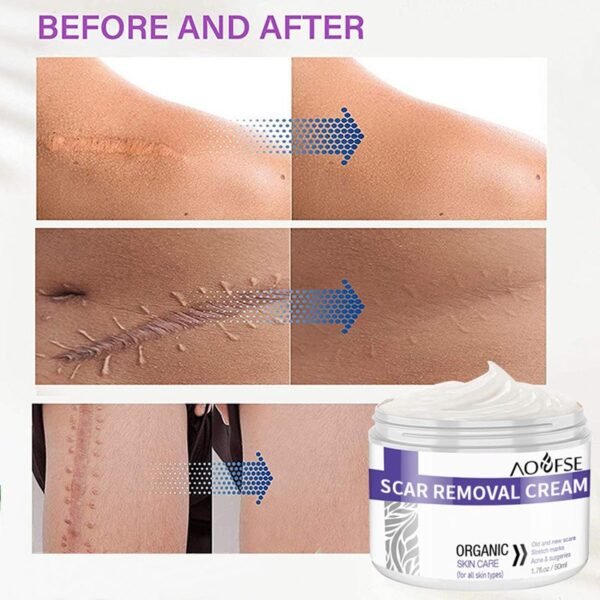 Nourishing Scar Care Gel – 2-Bottle Pack