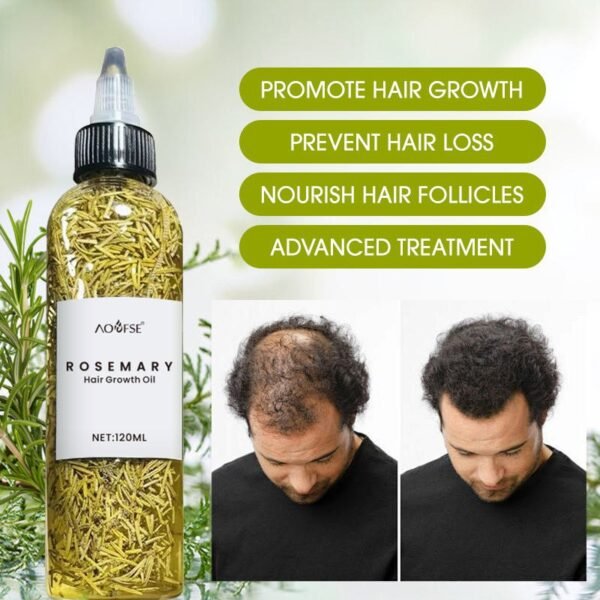 rosemary-strengthening-hair-oil-10253-03 Rosemary Strengthening Hair Oil – 2-Bottle Pack